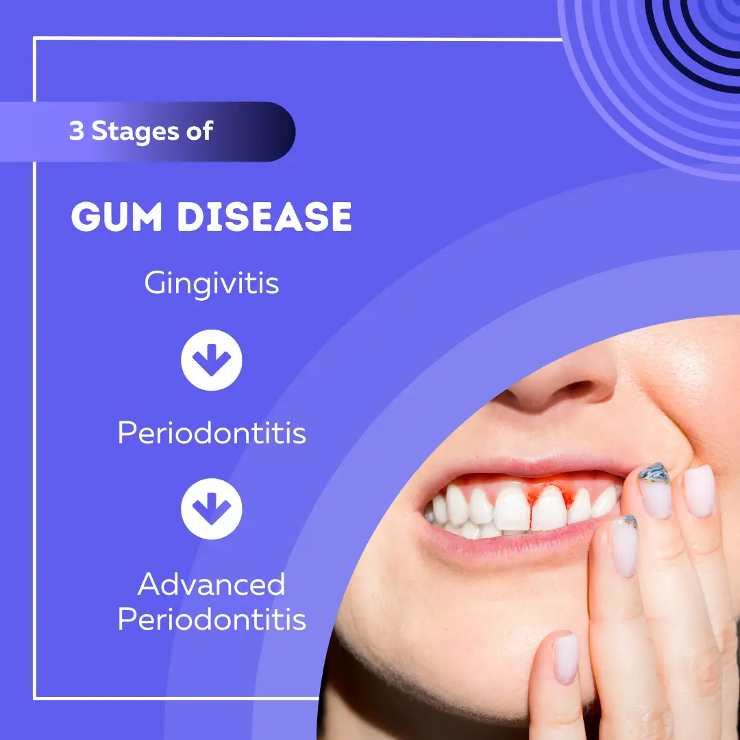 gum disease