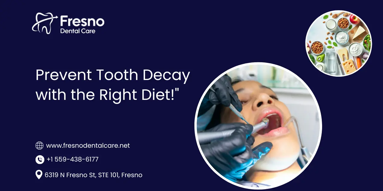 Blog 9 Healthy foods that help prevent tooth decay and promote strong teeth