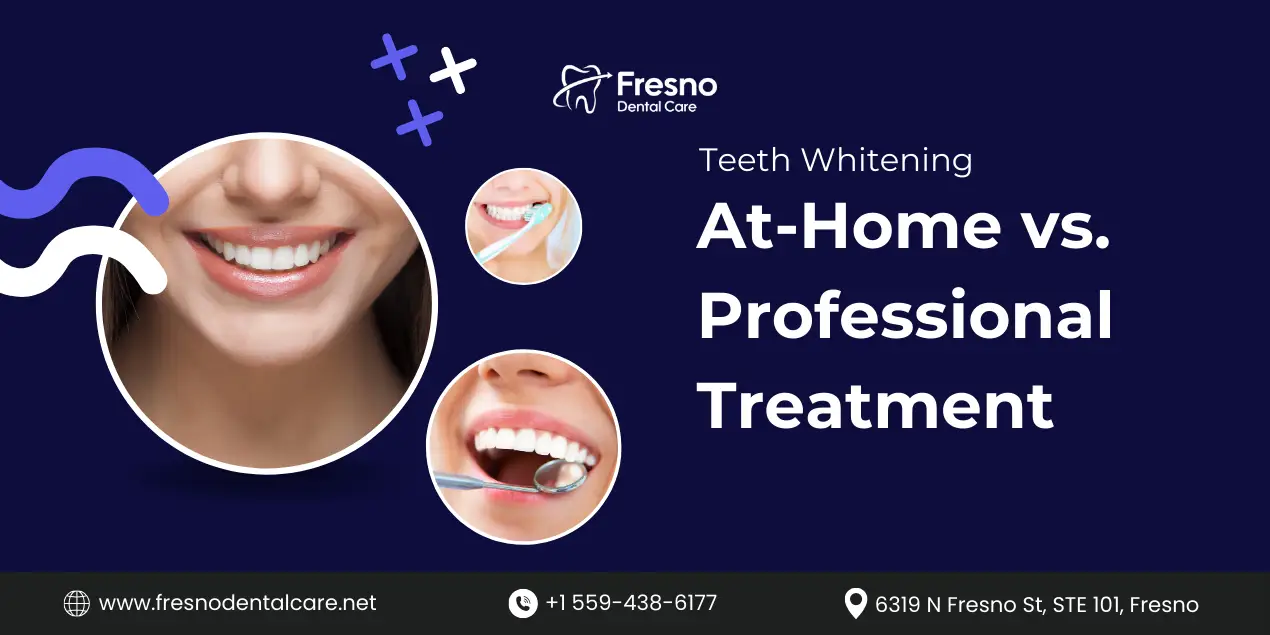 Blog 2 A comparison of at-home and professional teeth whitening treatments