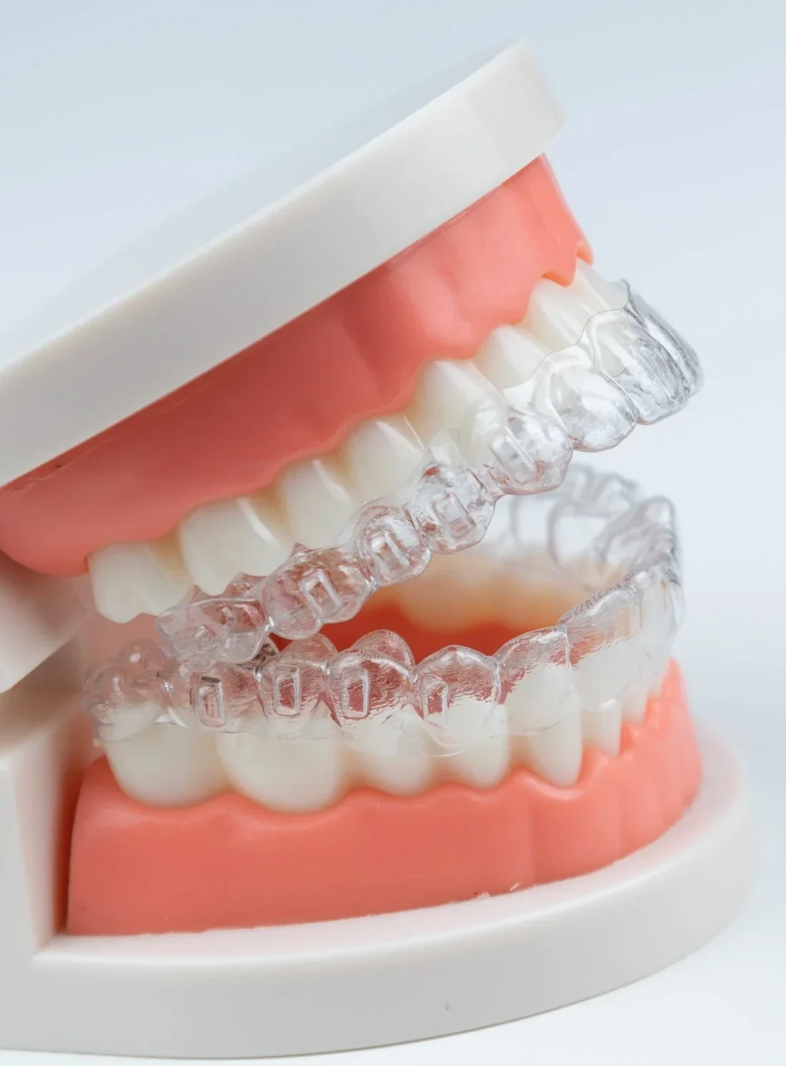 Invisalign clear aligners shown on dental model in Fresno clinic