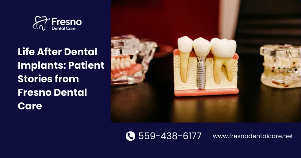 Life After Dental Implants: Patient Stories from Fresno Dental Care - Fresno Dental Care blog visual