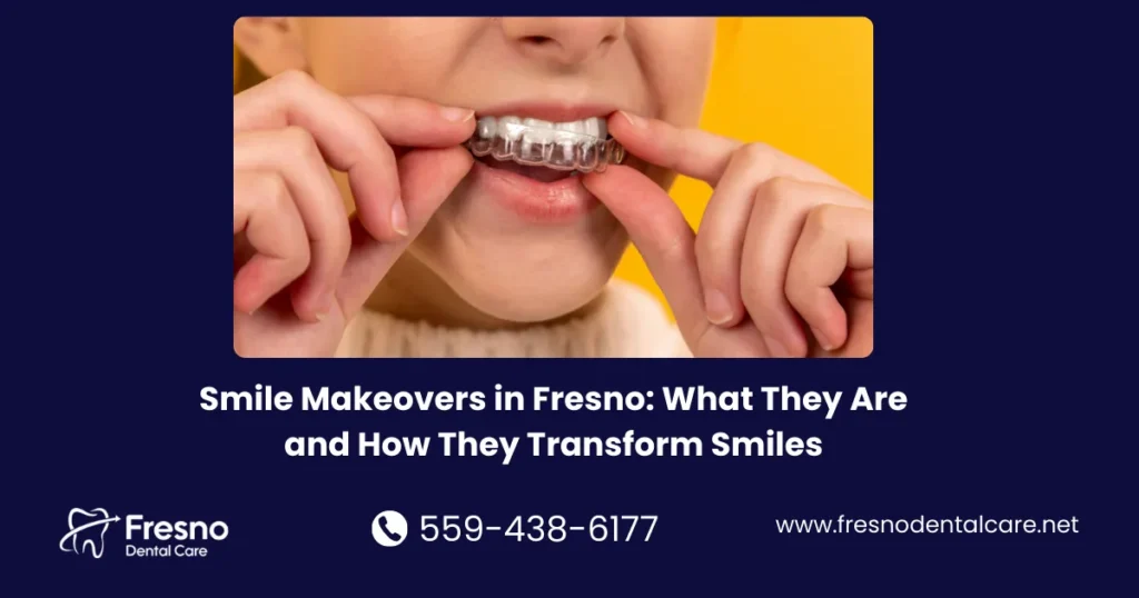 Smile Makeovers in Fresno: What They Are and How They Transform Smiles - Fresno Dental Care blog visual
