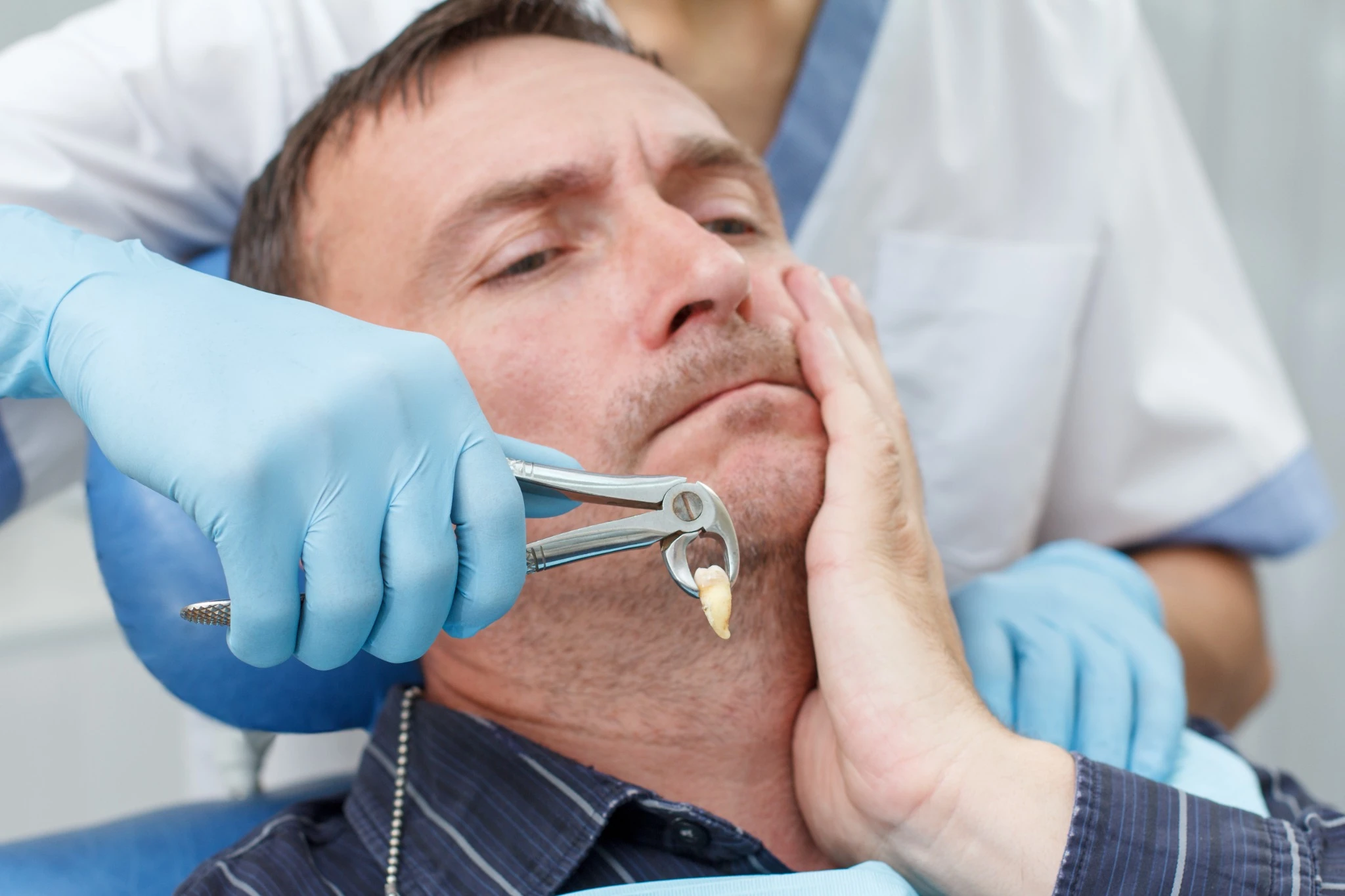 Close-up of wisdom tooth extraction at Fresno Dental Care