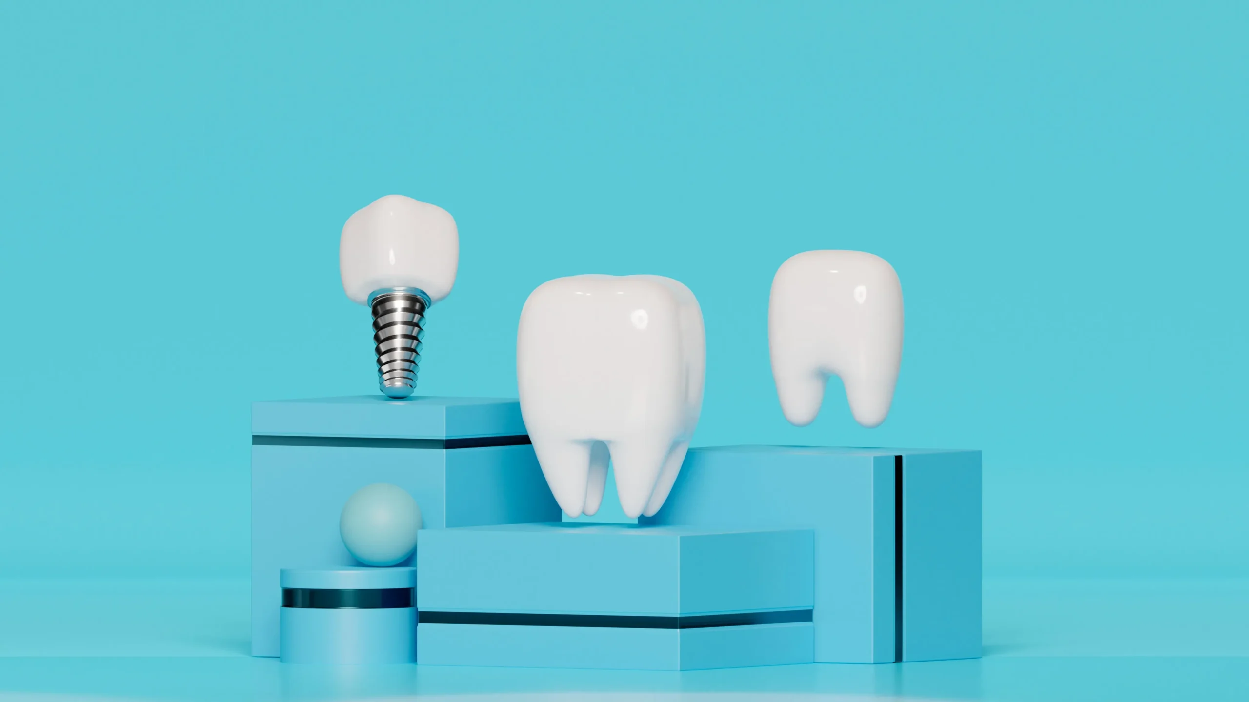 dental implant image