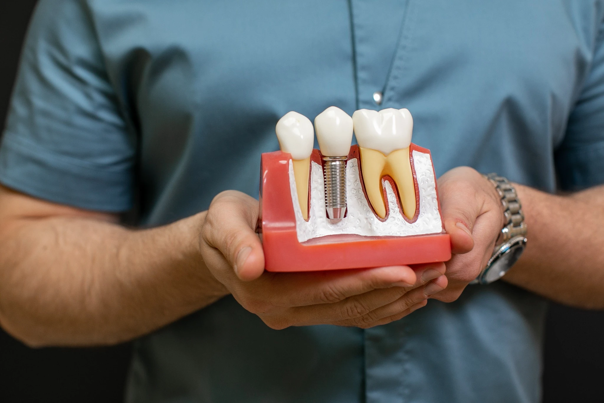 Dentist holding dental implant teaching model